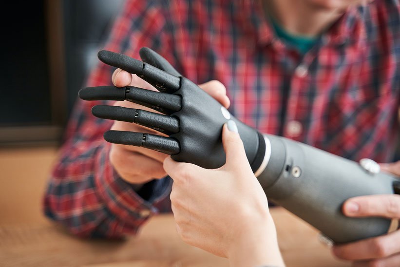 3d scan human body a custom prosthetic arm